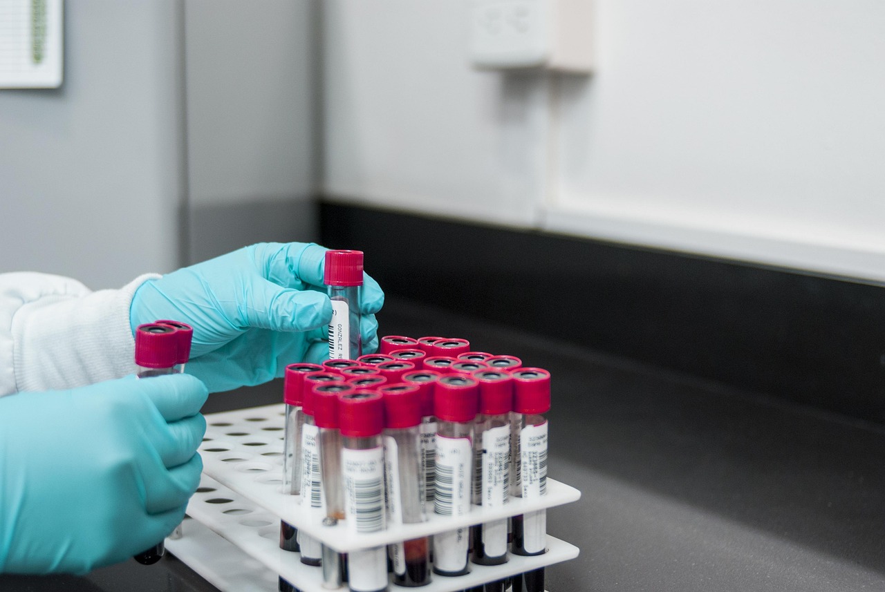 Healthcare Data Analysis for Six Sigma